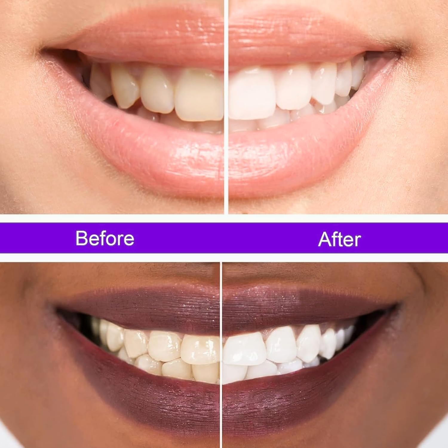 Hismile v34 Colour Corrector, Purple Teeth Whitening, Tooth Stain Removal, Teeth Whitening Booster, Purple Toothpaste - Packaging May Vary